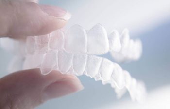 Invisalign aligners.