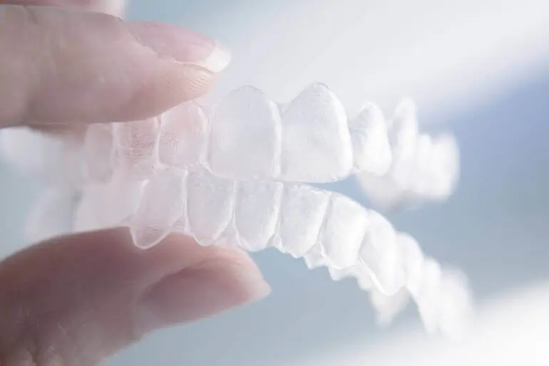 Invisalign aligners.