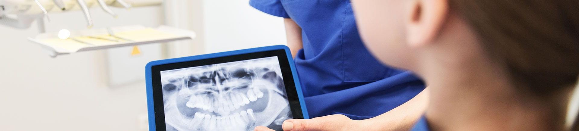 A dentist showing digital dental X-rays to the patient.